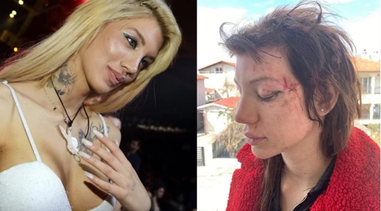 Μαρία Αλεξάνδρου: «Ήταν ένας πραγματικός εφιάλτης» - Τι είχε δηλώσει για τον βασανισμό της από την ιδιοκτήτρια του κέντρου αισθητικής στη Θεσσαλονίκη