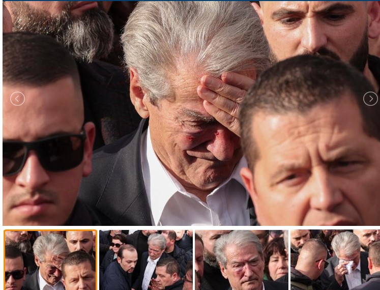 Προπηλακισμός του Σαλί Μπερίσα σε πορεία: Επιτέθηκαν με μπουνιές στον πρώην πρωθυπουργό της Αλβανίας