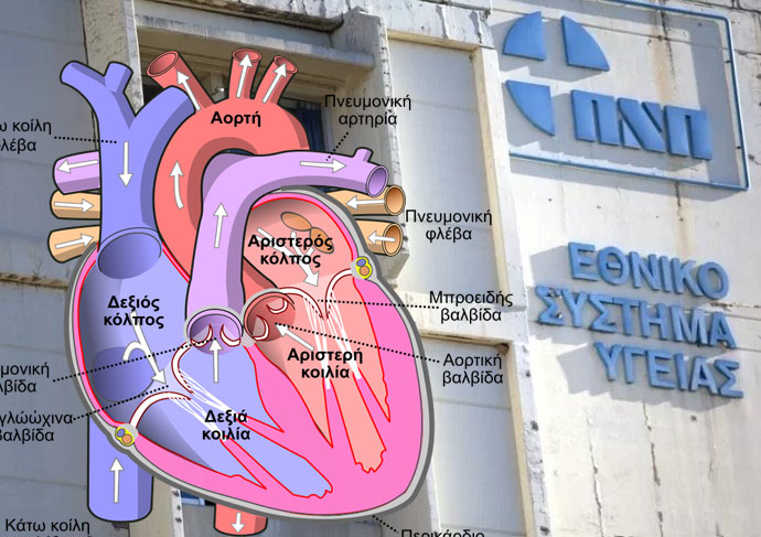 Αλλαγή αορτικής βαλβίδας χωρίς νυστέρι (στην Πάτρα)! Πρωτιά για την καρδιολογική κλινική του Πανεπιστημιακού Νοσοκομείου